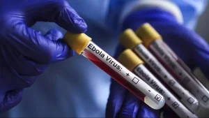 2007230-ebola-1