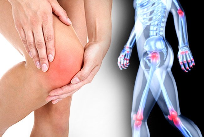 joint-pain